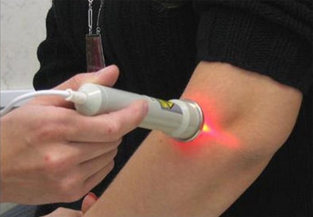 Пациенту проводят лечение лазером на руке