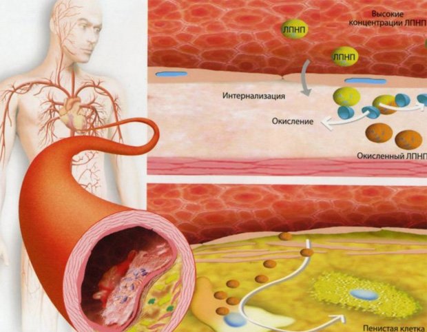 Схематическое изображение патологии метаболизма человека