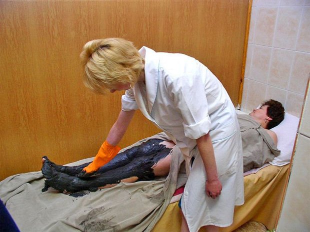 Медицинская сестра в санатории обмазывает пациентку нефтяной мазью