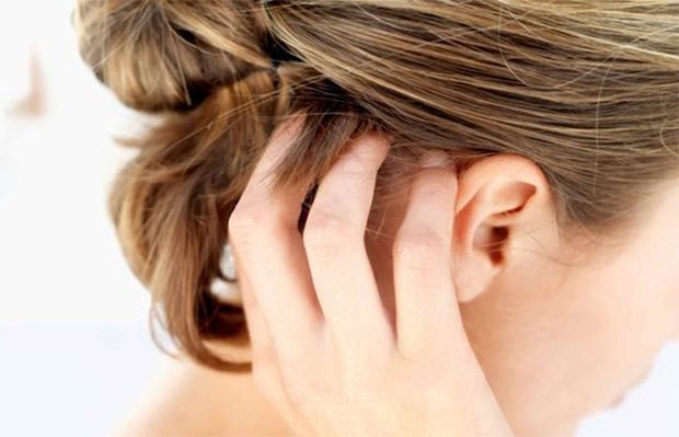 Девушка чешет кожу голову из-за зуда от болезни